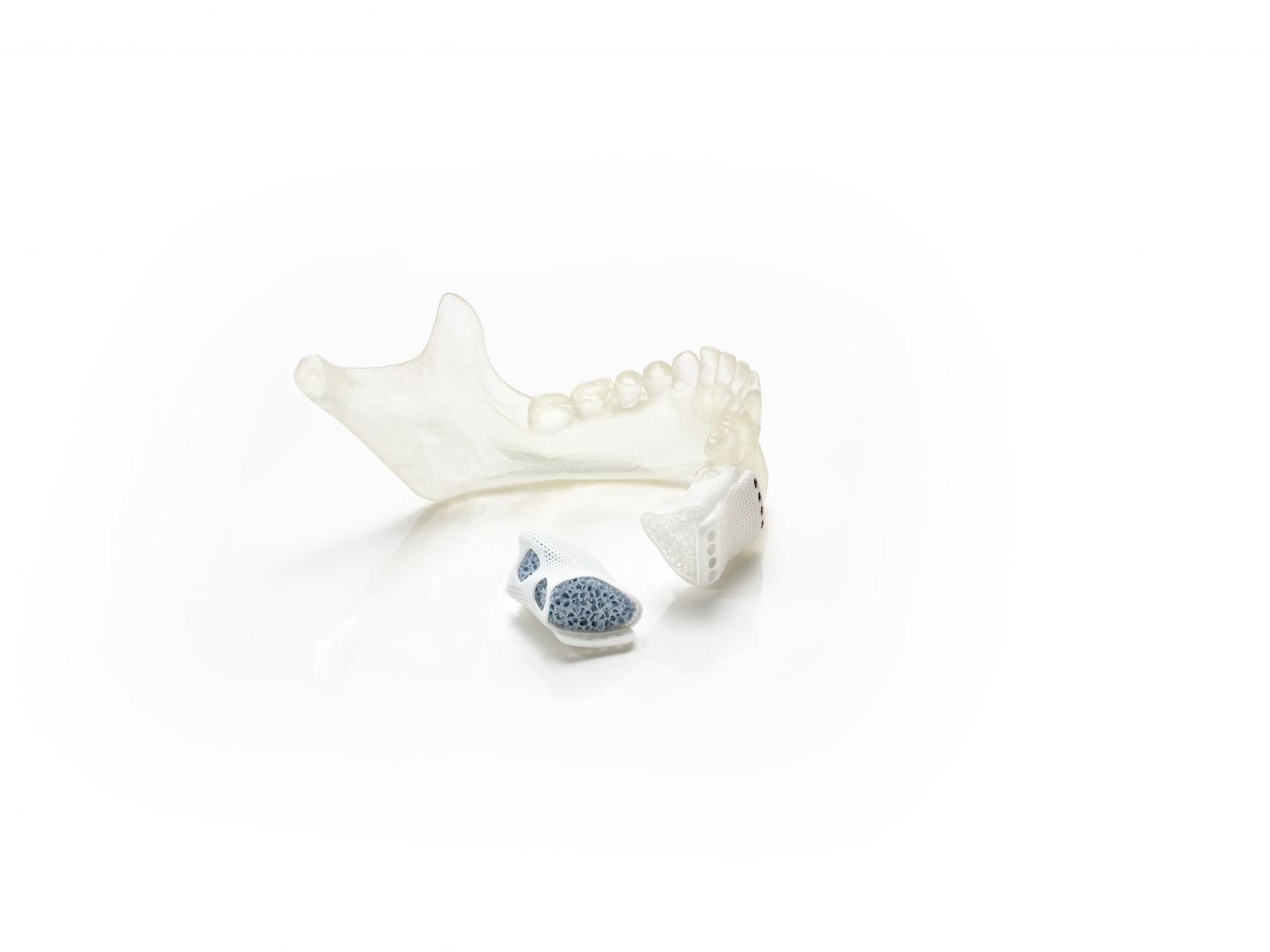 Did you know that complete bone healing is possible thanks to ceramic 3D printing?